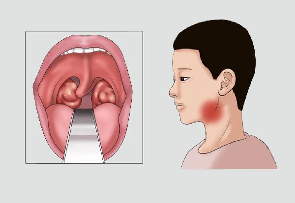 医师提示：6种病根本无法彻底治好，假如有人说能治，是在骗你